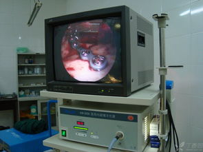 專(zhuān)利產(chǎn)品 內(nèi)窺鏡輔助新型穿頰器在頜面骨骨折內(nèi)固定中的應(yīng)用及計(jì)算機(jī)軟硬件輔助系統(tǒng)集成